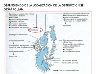 DEPENDIENDO DE LA LOCALIZACION DE LA OBTRUCCION SE
DESARROLLAN:
 