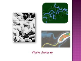 Vibrio cholerae
 