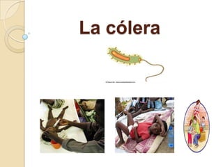 La cólera
 