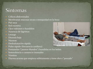  Cólicos abdominales
 Membranas mucosas secas o resequedad en la boca
 Piel seca
 Sed excesiva
 Ojos vidriosos o hundidos
 Ausencia de lágrimas
 Letargo
 Diuresis baja
 Náuseas
 Deshidratación rápida
 Pulso rápido (frecuencia cardíaca)
 Fontanelas ("puntos blandos") hundidas en los bebés
 Somnolencia o cansancio inusuales
 Vómitos
 Diarrea acuosa que empieza súbitamente y tiene olor a "pescado"
 