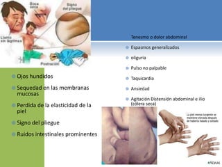  Ojos hundidos
 Sequedad en las membranas
mucosas
 Perdida de la elasticidad de la
piel
 Signo del pliegue
 Ruidos intestinales prominentes
 Tenesmo o dolor abdominal
 Espasmos generalizados
 oliguria
 Pulso no palpable
 Taquicardia
 Ansiedad
 Agitación Distensión abdominal e ilio
(cólera seca)
 