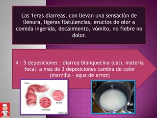Las 1eras diarreas, con llevan una sensación de
   llenura, ligeras flatulencias, eructos de olor a
comida ingerida, decaimiento, vómito, no fiebre no
                         dolor.




4 – 5 deposiciones : diarrea blanquecina (cal), materia
    fecal a mas de 3 deposiciones cambia de color
               (marcilla – agua de arroz)
 