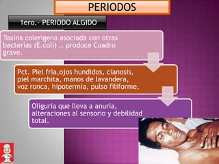 PERIODOS
     1ero.- PERIODO ALGIDO

Toxina colerìgena asociada con otras
bacterias (E.coli) .. produce Cuadro
grave.

    Pct. Piel frìa,ojos hundidos, cianosis,
    piel marchita, manos de lavandera,
    voz ronca, hipotermia, pulso filiforme,

         Oliguria que lleva a anuria,
         alteraciones al sensorio y debilidad
         total.
 