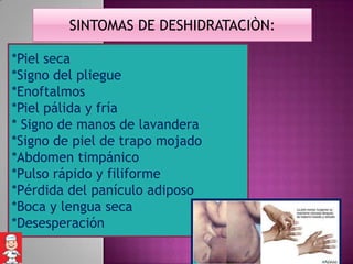 SINTOMAS DE DESHIDRATACIÒN:

*Piel seca
*Signo del pliegue
*Enoftalmos
*Piel pálida y fría
* Signo de manos de lavandera
*Signo de piel de trapo mojado
*Abdomen timpánico
*Pulso rápido y filiforme
*Pérdida del panículo adiposo
*Boca y lengua seca
*Desesperación
 