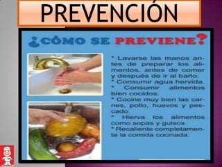 PREVENCIÓN
 