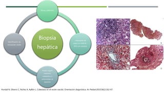 Biopsia
hepática
Eficaz y definitivo
>6semanas de
edad con AVB 90 –
95% con cambios
Puede sugerir
trastorno
metabólico o
enfermedad de
depósito
Identificación de
inclusiones virales
Hondal N, Silverio C, Núñez A, Ayllón L. Colestasis en el recién nacido. Orientación diagnóstica. An Pediatr2010;58(2):162-67.
 