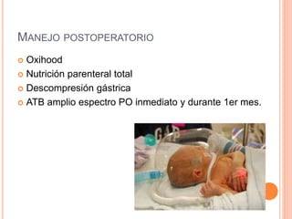 MANEJO POSTOPERATORIO
 Oxihood
 Nutrición parenteral total
 Descompresión gástrica
 ATB amplio espectro PO inmediato y durante 1er mes.
 