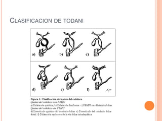 CLASIFICACION DE TODANI
 