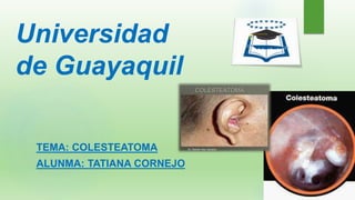 Universidad
de Guayaquil
TEMA: COLESTEATOMA
ALUNMA: TATIANA CORNEJO
 