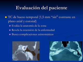 Evaluación del paciente
   TC de hueso temporal (1,5 mm “sin” contraste en
    plano axial y coronal)
       Evalúa la anatomía de la zona
       Revela la extensión de la enfermedad
       Busca complicaciones asintomáticas
 