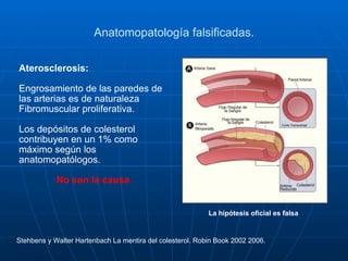 Anatomopatología falsificadas. Aterosclerosis: Engrosamiento de las paredes de las arterias es de naturaleza Fibromuscular proliferativa. Los depósitos de colesterol contribuyen en un 1% como máximo según los anatomopatólogos. No son la causa . Stehbens y Walter Hartenbach La mentira del colesterol. Robin Book 2002 2006.   La hipótesis oficial es falsa 