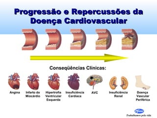 Progressão e Repercussões da
     Doença Cardiovascular




                        Conseqüências Clínicas:



Angina   Infarto do   Hipertrofia   Insuficiência   AVC   Insuficiência        Doença
         Miocárdio    Ventricular     Cardíaca               Renal            Vascular
                       Esquerda                                               Periférica




                                                                      Trabalhamos pela vida
 
