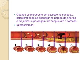 



Quando está presente em excesso no sangue,o
colesterol pode se depositar na parede de artérias
e prejudicar a passagem de sangue até o coração
(aterosclerose)

 