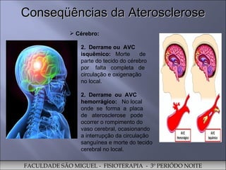 Cérebro:  Derrame ou  AVC isquêmico:  Morte  de  parte do tecido do cérebro por  falta  completa  de circulação e oxigenação  no local.  2.  Derrame  ou  AVC hemorrágico:  No local onde  se  forma  a  placa  de  aterosclerose  pode ocorrer o rompimento do vaso cerebral, ocasionando  a interrupção da circulação sanguínea e morte do tecido cerebral no local.  Conseqüências da Aterosclerose FACULDADE SÃO MIGUEL -  FISIOTERAPIA  -  3º PERIÓDO NOITE 