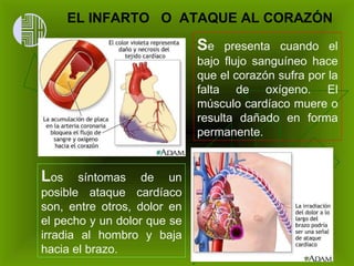 L os síntomas de un posible ataque cardíaco son, entre otros, dolor en el pecho y un dolor que se irradia al hombro y baja hacia el brazo.  S e presenta cuando el bajo flujo sanguíneo hace que el corazón sufra por la falta de oxígeno. El músculo cardíaco muere o resulta dañado en forma permanente.  EL INFARTO  O  ATAQUE AL CORAZÓN 