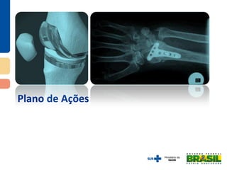 Plano de Ações
 
