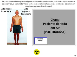 No caso de exames em pacientespolitraumatizados,imobilizadosnaprancha e portadores de
colarcervical, o numerador ficará com a face anterior voltadaparao técnico e a posterior em
contatocom a superfície do chassi.
Lado direito
do paciente
Lado
esquerdo
do paciente
Chassi
Paciente deitado
em AP
(POLITRAUMA).
10
 