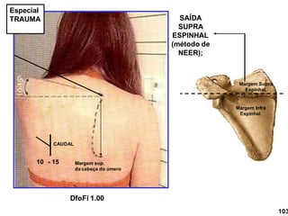 SAÍDA
SUPRA
ESPINHAL
(método de
NEER);
Margem sup.
da cabeça do úmero
CAUDAL
10 - 15
Margem Infra
Espinhal.
Margem Supra
Espinhal.
103
DfoFi 1.00
Especial
TRAUMA
 