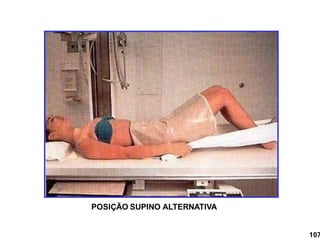 POSIÇÃO SUPINO ALTERNATIVA
107
 