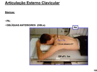Articulação Esterno Clavicular
Básicas:
• PA;
• OBLÍQUAS ANTERIORES (OBLs).

T2 – T3
DFoFi: 1m
7,5 cm distal à C7
PA
108
 
