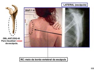 LATERAL (escápula)
RC: meio da borda vertebral da escápula
DfoFi 1 m
OBL.ANT.ESQ 45
Para visualizar corpo
da escápula.
111
 