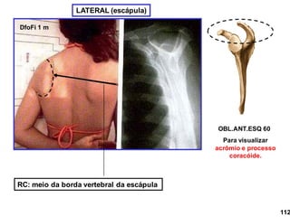 OBL.ANT.ESQ 60
Para visualizar
acrômio e processo
coracóide.
LATERAL (escápula)
DfoFi 1 m
RC: meio da borda vertebral da escápula
112
 