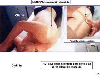 LATERAL (escápula) - decúbito
Palparbordas escapulares
OBL.30
RC: deve estar orientado para o meio da
borda lateral da escápula.
DfoFi 1m
113
 
