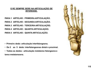 O RC SEMPRE SERÁ NA ARTICULAÇÃO DE
INTERESSE.
PARA 1 ARTELHO : PRIMEIRA ARTICULAÇÃO.
PARA 2 ARTELHO : SEGUNDA ARTICULAÇÃO.
PARA 3 ARTELHO : TERCEIRA ARTICULAÇÃO.
PARA 4 ARTELHO : QUARTA ARTICULAÇÃO.
PARA 5 ARTELHO : QUINTA ARTICULAÇÂO.
• Primeiro dedo: articulação interfalangeana.
• Do 2 ao 5 dedo: interfalangeanas distal e proximal.
• Todos os dedos : articulação metatarso falangeana e
tarso metatarseana.
115
 