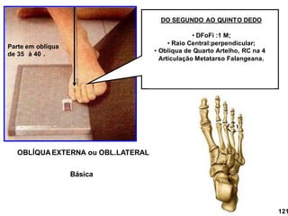 OBLÍQUA EXTERNA ou OBL.LATERAL
DO SEGUNDO AO QUINTO DEDO
• DFoFi :1 M;
• Raio Central:perpendicular;
• Oblíqua de Quarto Artelho, RC na 4
Articulação Metatarso Falangeana.
Parte em oblíqua
de 35 à 40 .
121
Básica
 