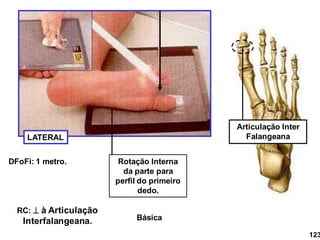 LATERAL
Rotação Interna
da parte para
perfil do primeiro
dedo.
RC:  à Articulação
Interfalangeana.
DFoFi: 1 metro.
Articulação Inter
Falangeana
123
Básica
 