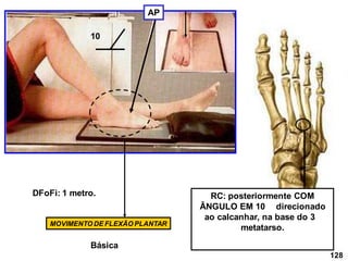 10
DFoFi: 1 metro. RC: posteriormente COM
ÂNGULO EM 10 direcionado
ao calcanhar, na base do 3
metatarso.
AP
MOVIMENTO DE FLEXÃO PLANTAR
128
Básica
 