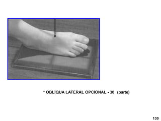 * OBLÍQUA LATERAL OPCIONAL - 30 (parte)
130
 