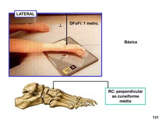 LATERAL
DFoFi: 1 metro.

RC: perpendicular
ao cuneiforme
médio
131
Básica
 