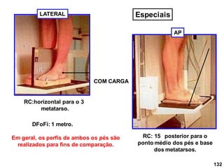 COM CARGA
RC:horizontal para o 3
metatarso.
LATERAL
DFoFi: 1 metro.
AP
RC: 15 posterior para o
ponto médio dos pés e base
dos metatarsos.
132
Em geral, os perfis de ambos os pés são
realizados para fins de comparação.
Especiais
 