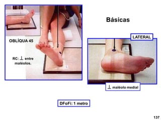 OBLÍQUA 45
DFoFi: 1 metro
RC:  entre
maléolos.
LATERAL
 maléolo medial
137
Básicas
 