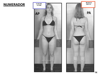 NUMERADOR
AP PA
14
 