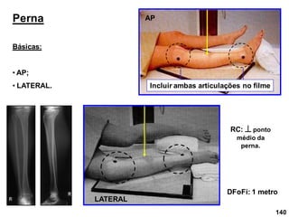 140
Perna
Básicas:
• AP;
• LATERAL.
RC:  ponto
médio da
perna.
DFoFi: 1 metro
Incluir ambas articulações no filme
LATERAL
AP
 