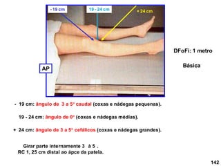 142
Girar parte internamente 3 à 5 .
RC 1, 25 cm distal ao ápce da patela.
DFoFi: 1 metro
19 - 24 cm: ângulo de 0 (coxas e nádegas médias).
- 19 cm: ângulo de 3 a 5 caudal (coxas e nádegas pequenas).
+ 24 cm: ângulo de 3 a 5 cefálicos (coxas e nádegas grandes).
19 - 24 cm + 24 cm
- 19 cm
AP
Básica
 