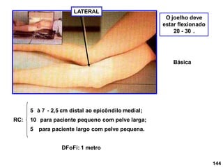 144
LATERAL
RC: 10 para paciente pequeno com pelve larga;
5 para paciente largo com pelve pequena.
5 à 7 -
DFoFi: 1 metro
2,5 cm distal ao epicôndilo medial;
O joelho deve
estar flexionado
20 - 30 .
Básica
 