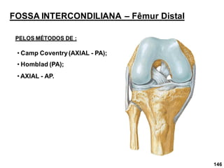 146
FOSSA INTERCONDILIANA – Fêmur Distal
PELOS MÉTODOS DE :
• Camp Coventry(AXIAL - PA);
• Homblad (PA);
• AXIAL - AP.
 
