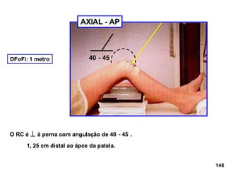 148
40 - 45
O RC é  à perna com angulação de 40 - 45 .
1, 25 cm distal ao ápce da patela.
DFoFi: 1 metro
AXIAL - AP
 