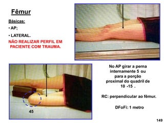 149
Fêmur
• AP;
• LATERAL.
DFoFi: 1 metro
No AP girar a perna
internamente 5 ou
para a porção
proximal do quadril de
10 -15 .
RC: perpendicular ao fêmur.
45
NÃO REALIZAR PERFIL EM
PACIENTE COM TRAUMA.
Básicas:
 