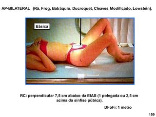 159
AP-BILATERAL
RC: perpendicular 7,5 cm abaixo da EIAS (1 polegada ou 2,5 cm
acima da sínfise púbica).
DFoFi: 1 metro
(Rã, Frog, Batráquio, Ducroquet, Cleaves Modificado, Lowstein).
Básica
 