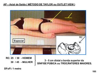 160
AP – Axial de Saída ( MÉTODO DE TAYLOR ou OUTLET VIEW )
RC: 25 / 30 - HOMEM
30 / 45 - MULHER
DFoFi: 1 metro
3 - 5 cm distal a borda superior da
SÍNFISE PÚBICA ou TROCÂNTERES MAIORES.
Especial
 