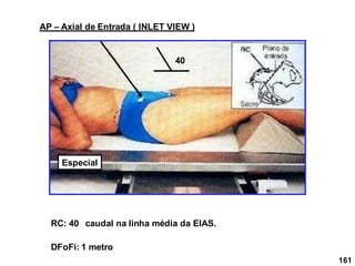 161
AP – Axial de Entrada ( INLET VIEW )
RC: 40 caudal na linha média da EIAS.
DFoFi: 1 metro
40
Especial
 