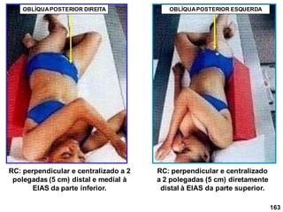 163
RC: perpendicular e centralizado a 2
polegadas (5 cm) distal e medial à
ElAS da parte inferior.
RC: perpendicular e centralizado
a 2 polegadas (5 cm) diretamente
distal à ElAS da parte superior.
OBLÍQUAPOSTERIOR DIREITA OBLÍQUAPOSTERIOR ESQUERDA
 
