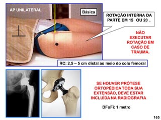 165
ROTAÇÃO INTERNA DA
PARTE EM 15 OU 20 .
RC: 2,5 – 5 cm distal ao meio do colo femoral
DFoFi: 1 metro
SE HOUVER PRÓTESE
ORTOPÉDICA TODA SUA
EXTENSÃO, DEVE ESTAR
INCLUÍDA NA RADIOGRAFIA
AP UNILATERAL
NÃO
EXECUTAR
ROTAÇÃO EM
CASO DE
TRAUMA.
Básica
 