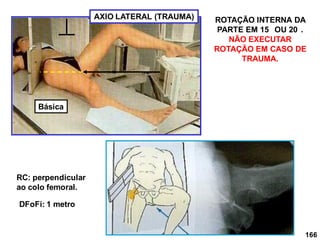 166
AXIO LATERAL (TRAUMA)
RC: perpendicular
ao colo femoral.
DFoFi: 1 metro
ROTAÇÃO INTERNA DA
PARTE EM 15 OU 20 .
NÃO EXECUTAR
ROTAÇÃO EM CASO DE
TRAUMA.
Básica
 
