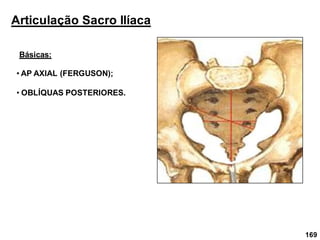 169
Articulação Sacro Ilíaca
Básicas:
• AP AXIAL (FERGUSON);
• OBLÍQUAS POSTERIORES.
 