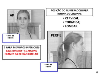 POSIÇÃO DO NUMERADORPARA
ROTINA DE COLUNAS
• CERVICAL;
• TORÁCICA;
• LOMBAR.
E PARA MEMBROS INFERIORES
EXCETUANDO– SE ALGUNS
EXAMES DA REGIÃO PATELAR
AP
PERFIL
17
 